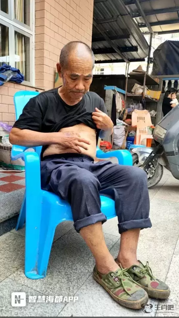 手术后金属夹滞留体内？漳州八旬老人腹痛难忍！医院回应插图