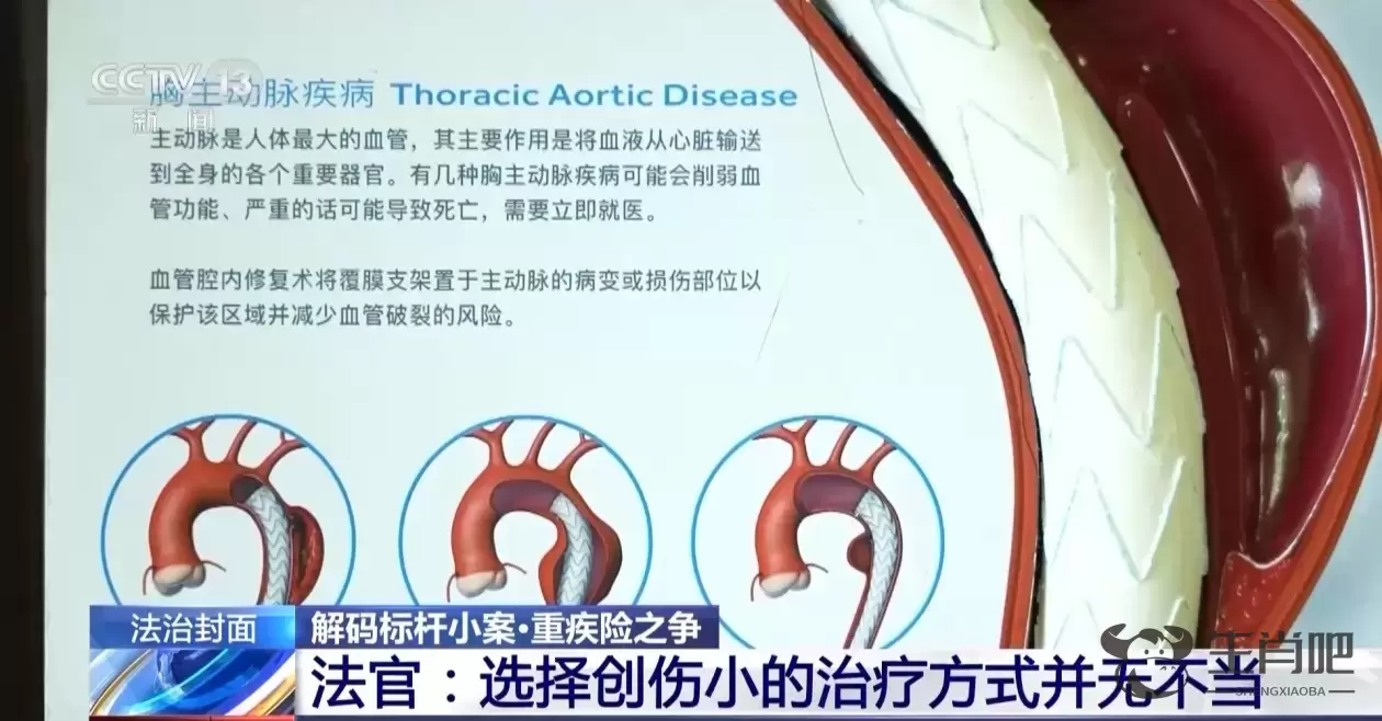 买了重疾险却不能赔付？化解理赔难题法院这样判插图8