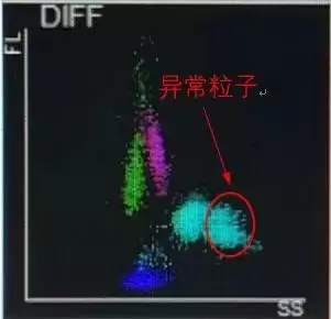 上海22岁小伙头痛咳嗽，忽冷忽热！一年前曾出国游玩，医生：这种病严重可致命插图1