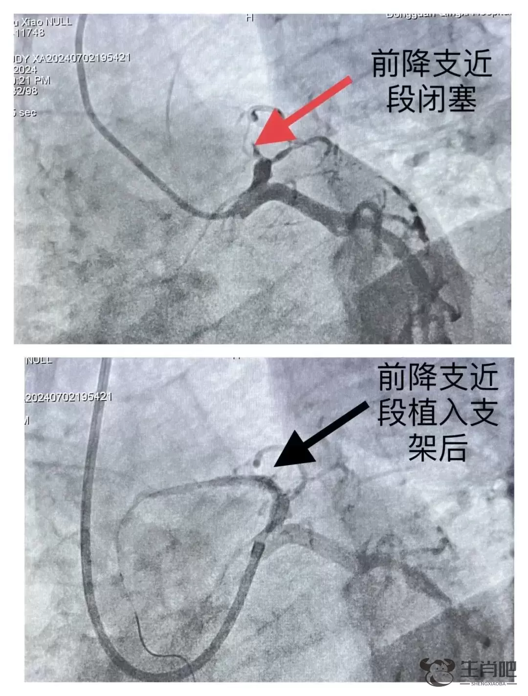 “急疯了！”被连挂5次，医生坚持电话“轰炸”最终抢回男子一条命插图6